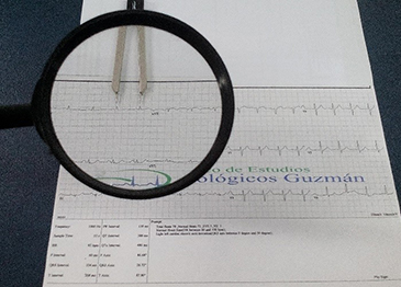 Electrocardiograma