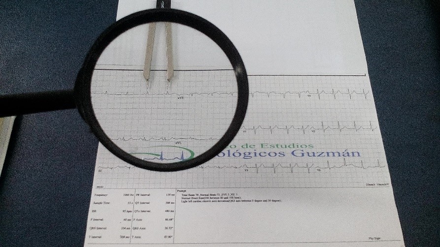 Electrocardiograma